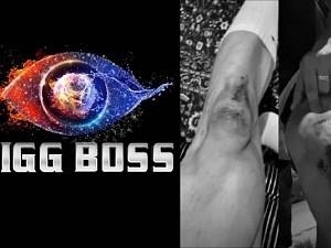 Bigg Boss star badly injured after guys on bike attacked him on the streets, shares video!